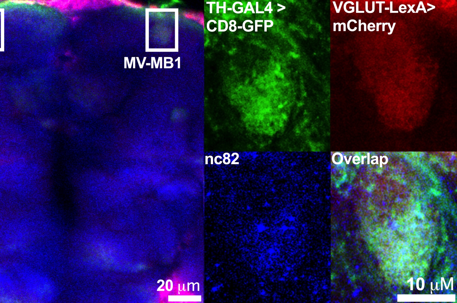 Freyberg & Colleagues Neuron 2017