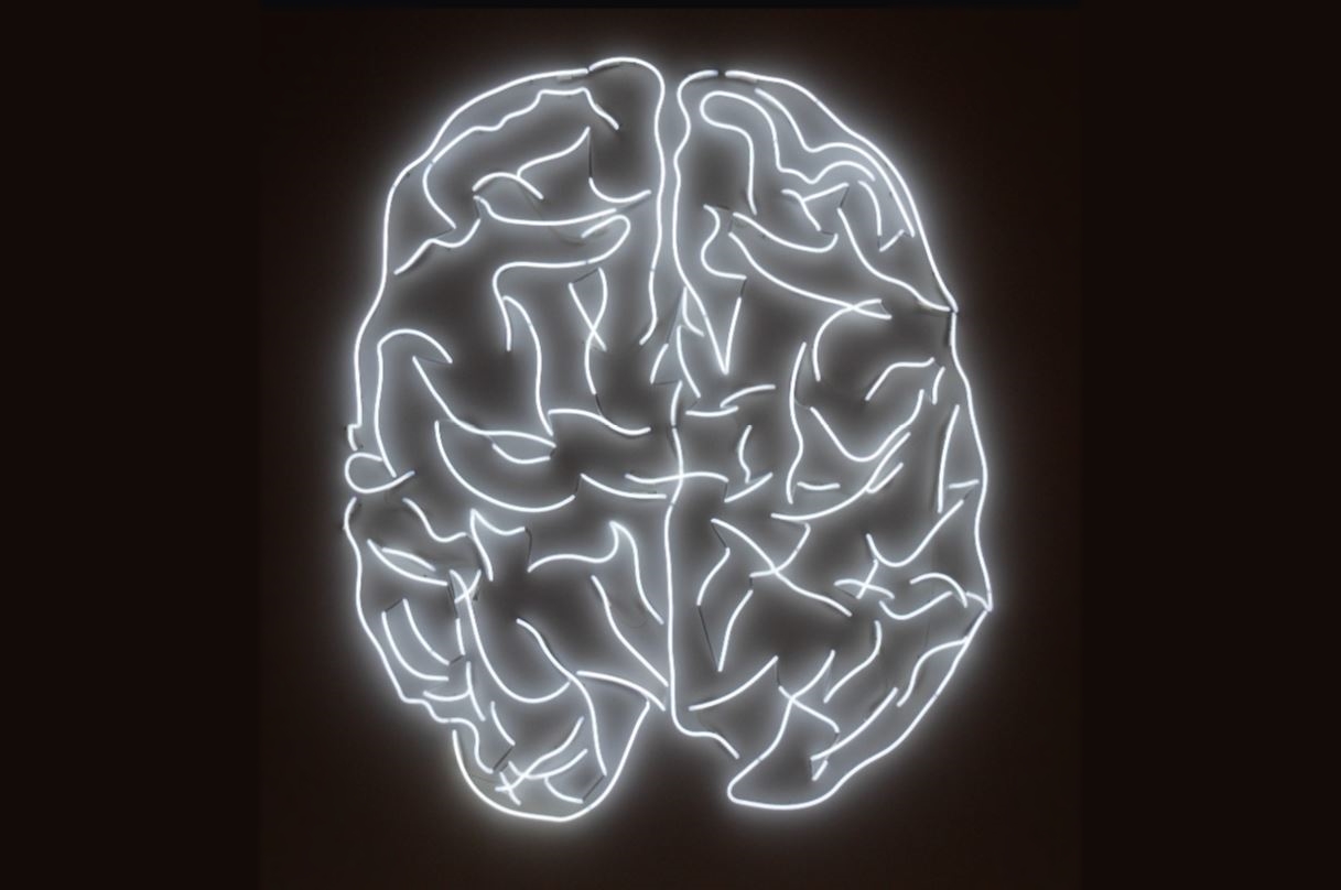 Photo Credit: Electric Brain by Michael Coghlan Photo Credit: Electric Brain by Michael Coghlan