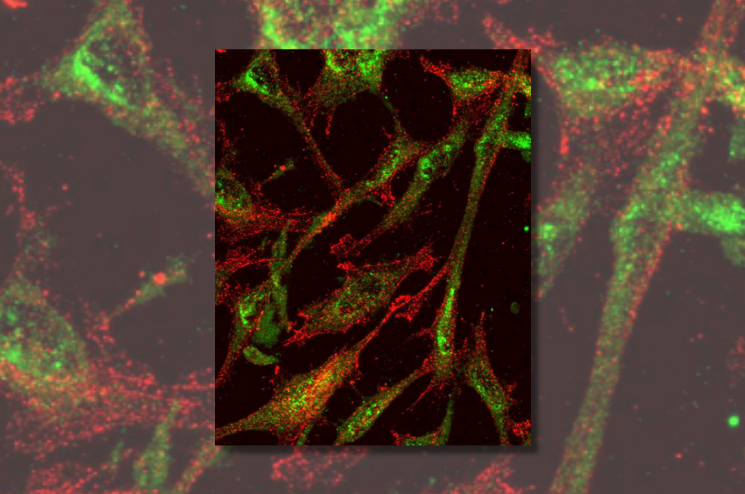 New Protective Marker in Dopamine Neurodegeneration in the Brain New Protective Marker in Dopamine Neurodegeneration in the Brain