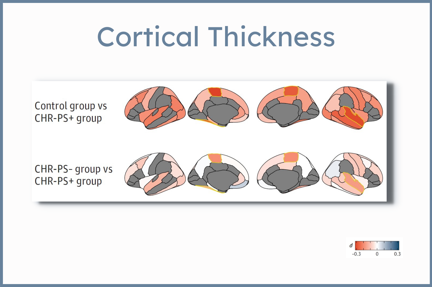 JAMA Psychiatry Study Links Cortical Brain Thinning to Development of Psychosis