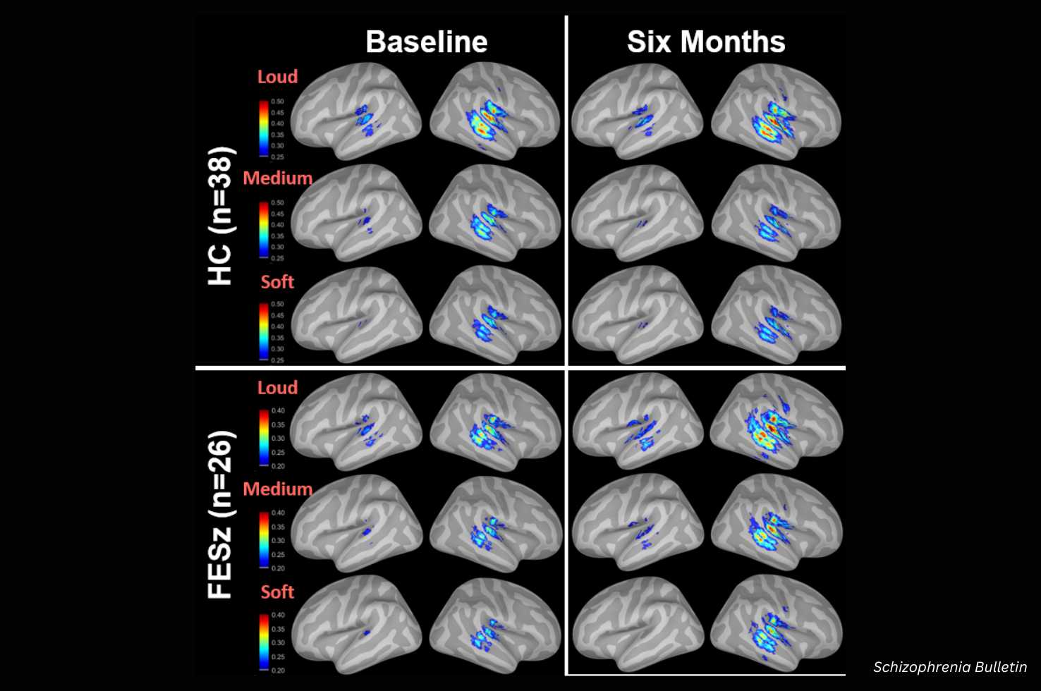 Brain Image