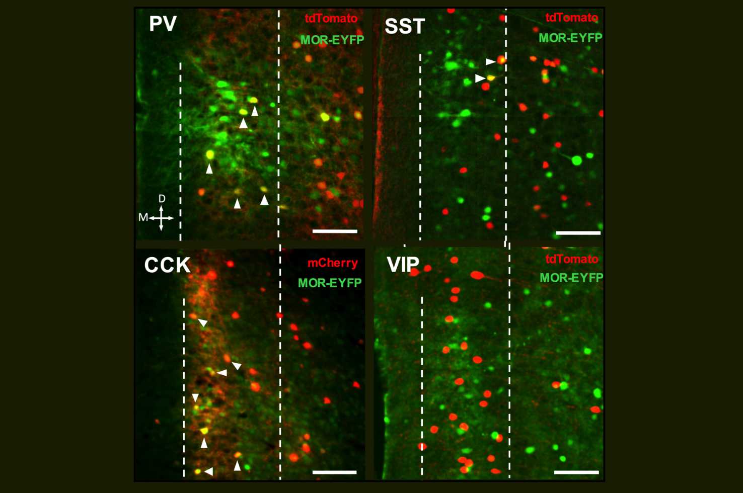 Image from Joffe et al. Journal of Neuroscience 2025 Image from Joffe et al. Journal of Neuroscience 2025