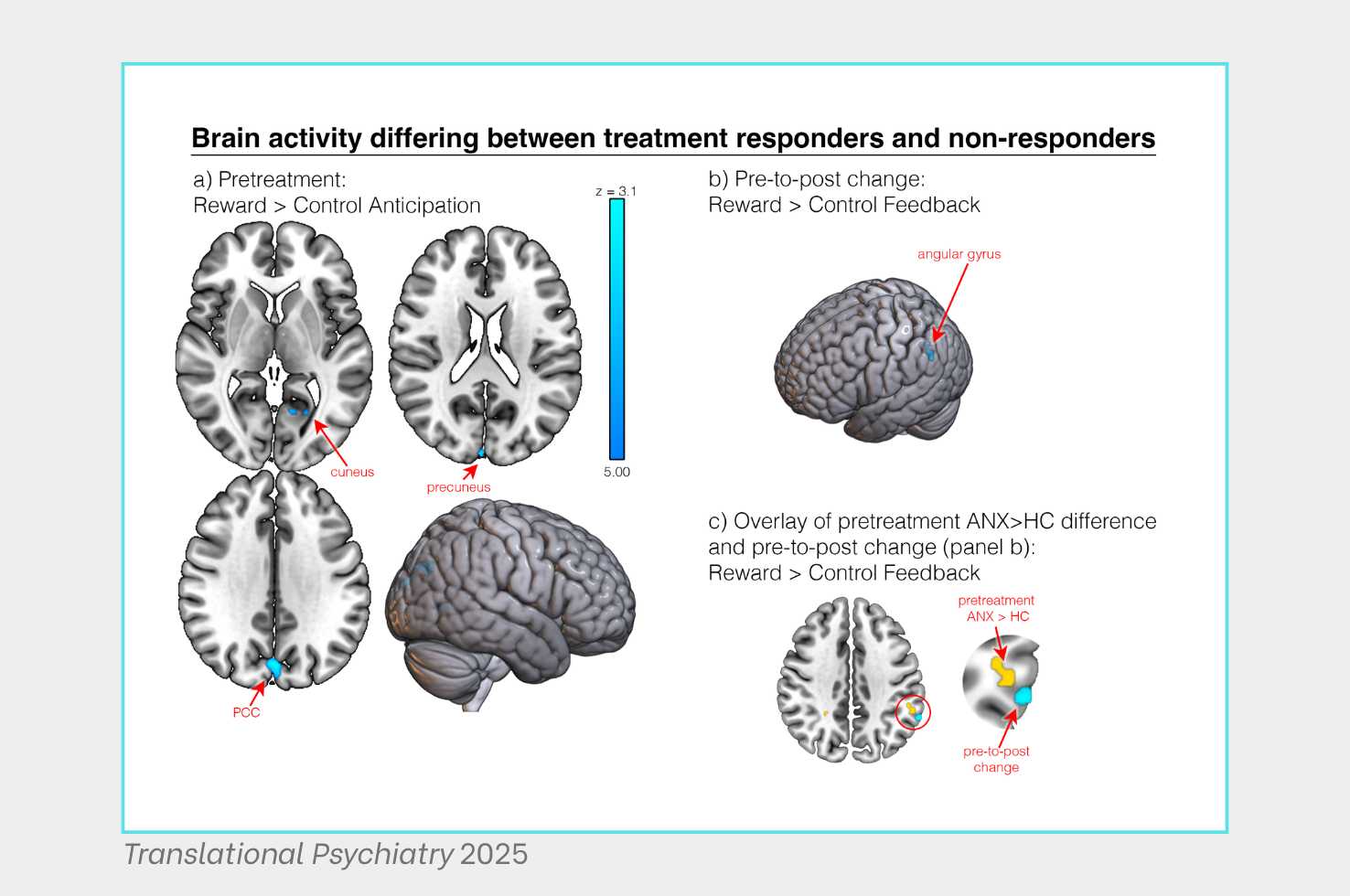Images from Ladouceur & Colleagues Translational Psychiatry 2025