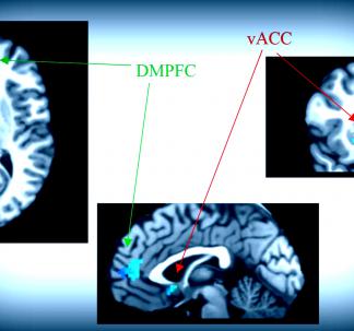 Price et al Biological Psychiatry 2018