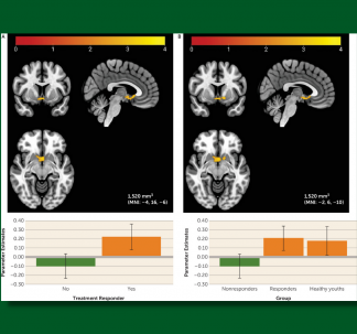 Forbes & Colleagues American Journal of Psychiatry 2021