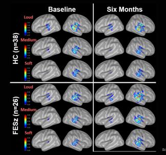 Brain Image